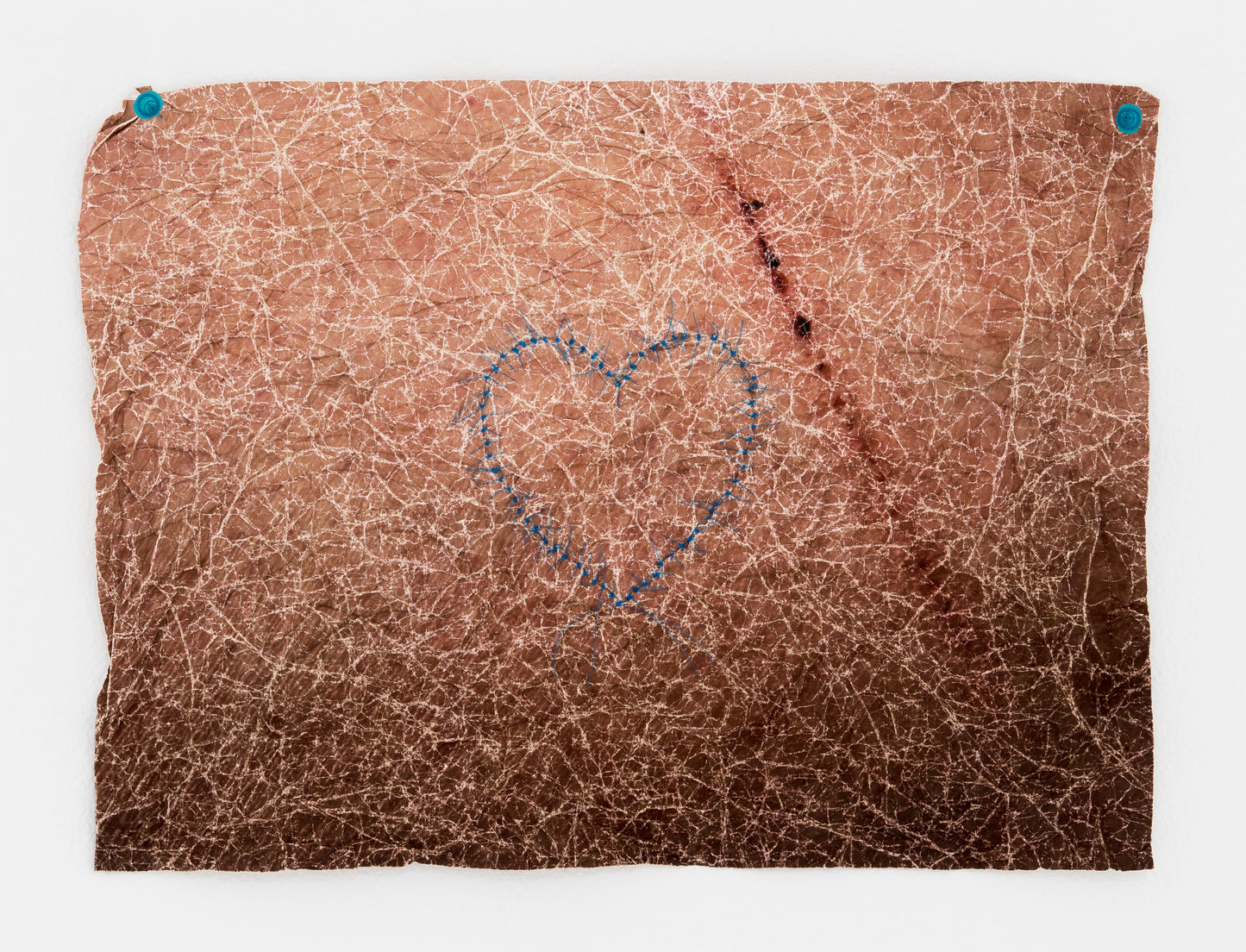 Mal d'amour 1 à 5  by Yannick De Serre