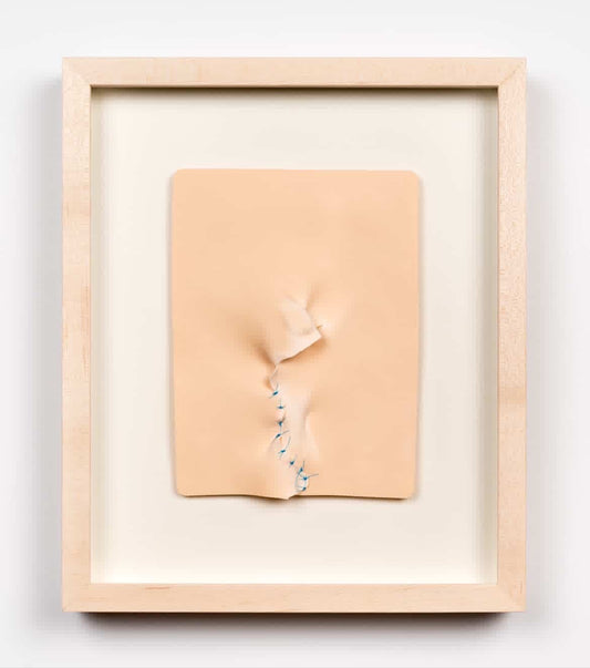 Kintsugi 1 by Yannick De Serre
